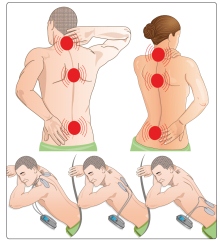 illustration veinoplus back